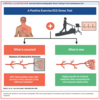 Rethinking False Positive Exercise Electrocardiographic Stress Tests by Assessing Coronary Microvascular Function