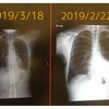 ローブレナ始めて25日目