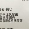 術前検査