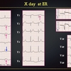 【ECG-399】answer