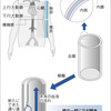 大動脈解離