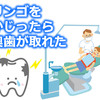 リンゴをかじったら歯が取れた 正確には被せ歯(クラウン)が取れた