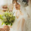 美容鍼は結婚式前にオススメ