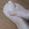 捻挫から腓骨筋腱炎と痛み過敏症(CRPS)   リハビリ5回目 ⑧  