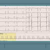 【ECG-401】answer