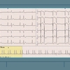 【ECG-401】answer