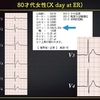 ECG-267：answer(1/2)