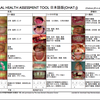 急性期脳卒中への歯科口腔ケア介入について