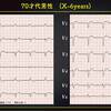 ECG-276 : answer(1/2)