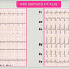 ECG-374：answer (2/2)