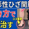 【変形性ひざ関節症】痛くならない歩き方 重要な2つのポイント#101