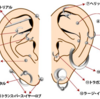 ピアス：スナッグが腫れる