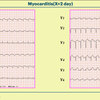 ECG-390：answer(2/2)    激烈な胸痛でER受診となった20代男性 心エコーのポイント