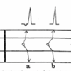 junctional rhythmの心電図の特徴・定義