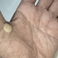 整形外科領域