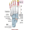 足の裏の痛み　母趾種子骨障害