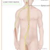 筋萎縮性側索硬化症について。