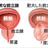 前立腺レーザー手術を受ける　（10月17日）