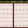 ECG-203：Low voltageを考える２症例です。