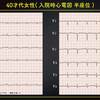 ECG-272：answer