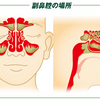 それ『蓄膿症』かもよ！？眼底・歯が痛い。熱・風邪の症状がある。