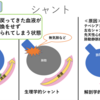 呼吸不全の病態②　シャントとその対応