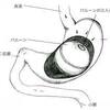 胃内バルーン　2週間