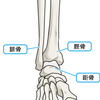 子供の足首の骨折後の違和感。