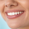 Wider Smiles : Get Strong & White Teeth Easily