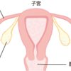 卵管閉塞と冷え性の原理は抽象度をあげれば同じ。