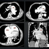 ECG-120：answer