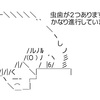 虫歯治療