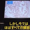 ころなワクチンで免疫力の低下もだけど、生殖機能もやられている可能性がある