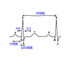 国家試験過去問解説・心電図その2