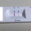 新生児糖尿病 + ダウン症児、新型コロナウイルスに感染する