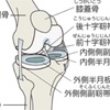 人工膝関節の注意点を少し🤔🌀🌀🌀