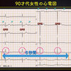 ECG-209：answer