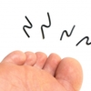足部環境の変化で歩様は変わる｜患者様の水虫の治療はきちんとできてますか？