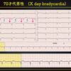 ECG-276：answer(2/2)