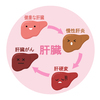 肝硬変に関する雑学