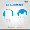 Hair surgery in India – Why you should consider it? 