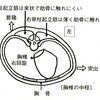 からだの歪みの要因その4