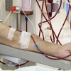 Hemodialysis Market 2023 | Industry Trends and Forecast 2028