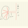 底辺医学生の夏休み（１０）