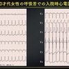 ECG-239：80才代 女性。呼吸苦での入院でした。