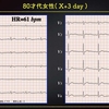 ECG-267：answer(2/2)