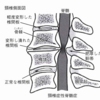 手が痺れる！！どんな病気があるの？？