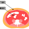 女性の内臓脂肪！原因と減らす方法は？