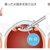 ウーファー用エンクロージャー（６）