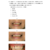 116回歯科医師国家試験【116B-72】義歯：新義歯製作編